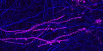 Myelin sheaths (magenta) wrapping axons (blue) in the rodent brain